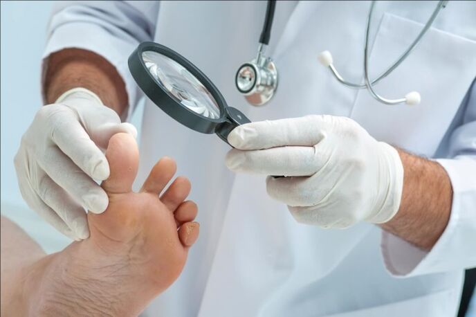 Before prescribing treatment for toenail fungus, the doctor will conduct an examination